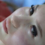 Czym jest mezoterapia igłowa? Wyjaśniamy!