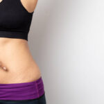 Jak pozbyć się rozstępów – bez specjalistycznych drogich zabiegów